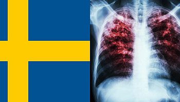 مهاجرت رادیولوژیست ها به سوئد